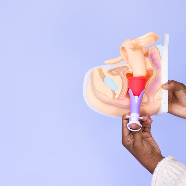 Load image into Gallery viewer, Combo Cup + Applicator
